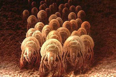 Dust mites in bedding